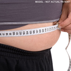 El sobrepeso o la obesidad
